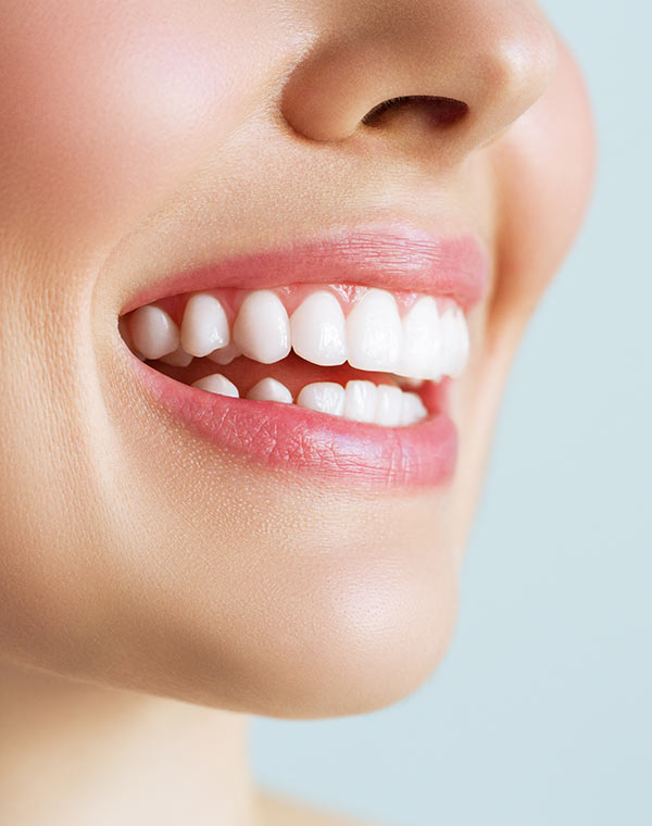 Has pensado en colocarte carillas dentales? I Clínica Dental Gramadent