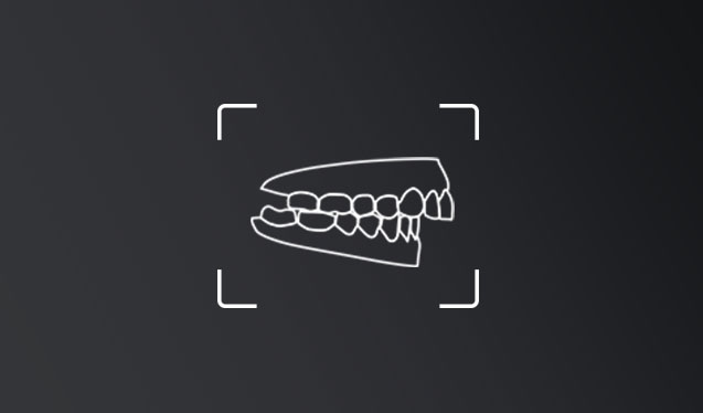 clase II dental