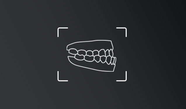 clase III dentall