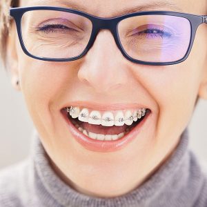 Lee más sobre el artículo ¿Cuándo empezar el tratamiento de ortodoncia?