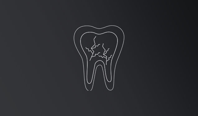 Endodoncia