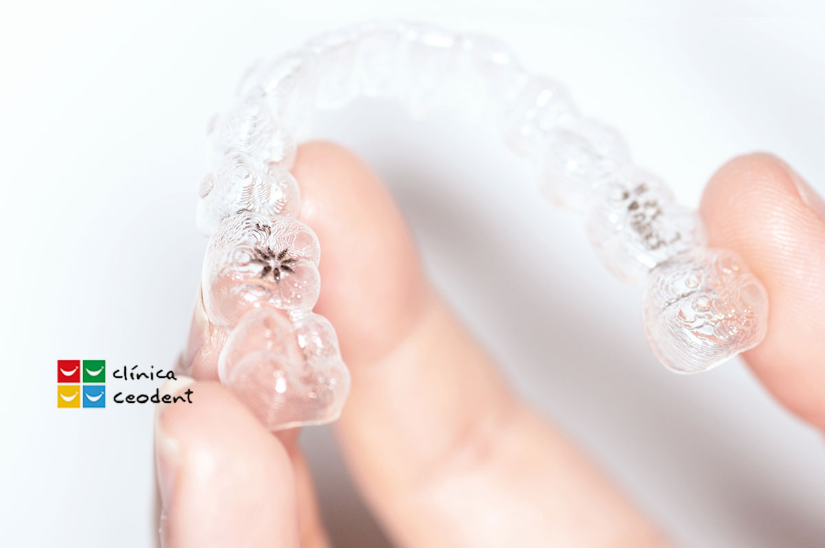 ¿POR QUÉ ELEGIR INVISALIGN? 7 invisaling Madrid