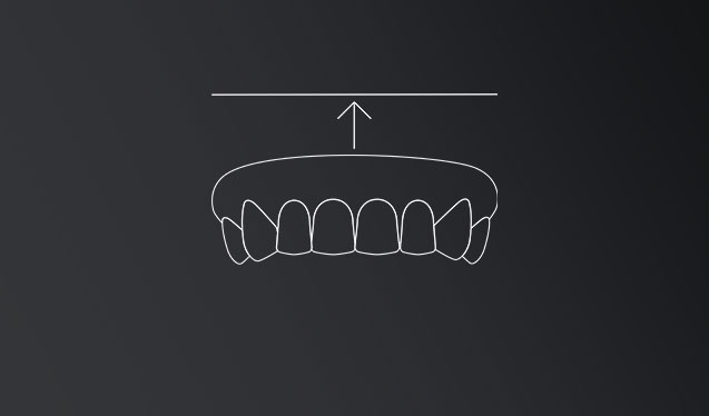 Protesis dental removible