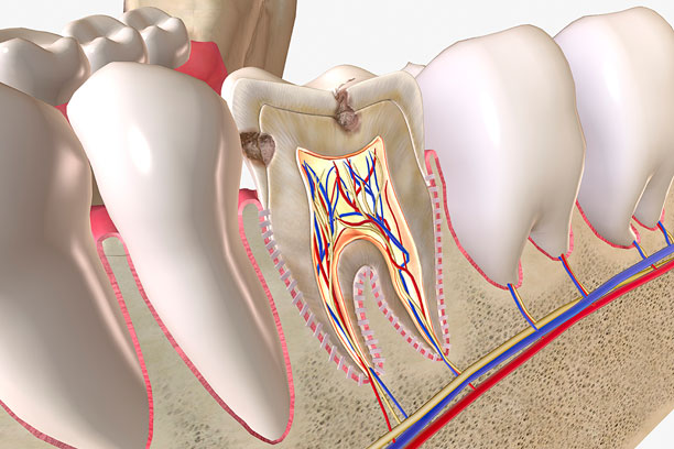 tratamiento de endodoncia o de conducto